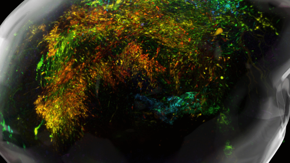 Hersenstam organoïden om CAR T-celtherapie te verbeteren