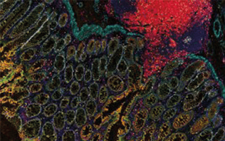 UCyTOF - Imaging Mass Cytometry