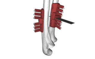 Fieldlab 3DMedical