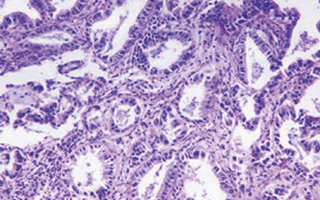 Digital Human Pathology
